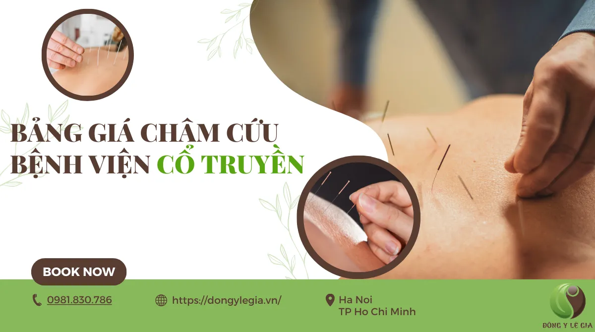 Bảng giá châm cứu bệnh viện y học cổ truyền