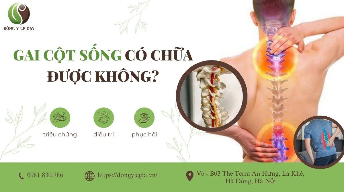 Gai Cột Sống Có Chữa Được Không