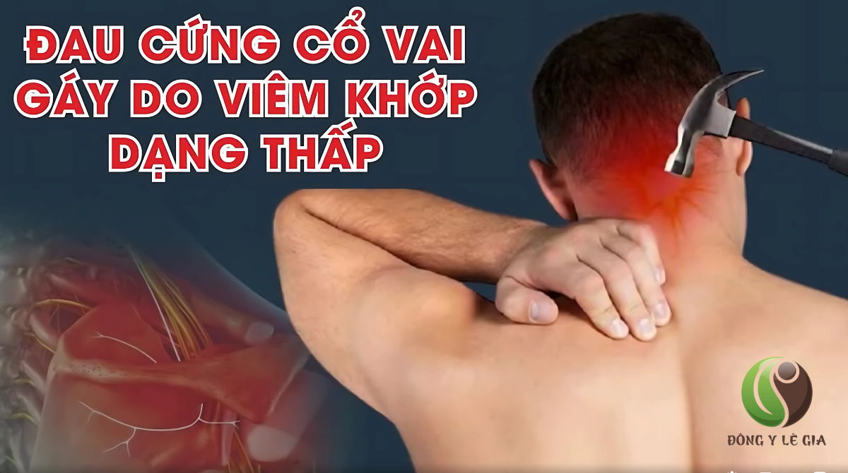 nguyên nhân đau vai gáy