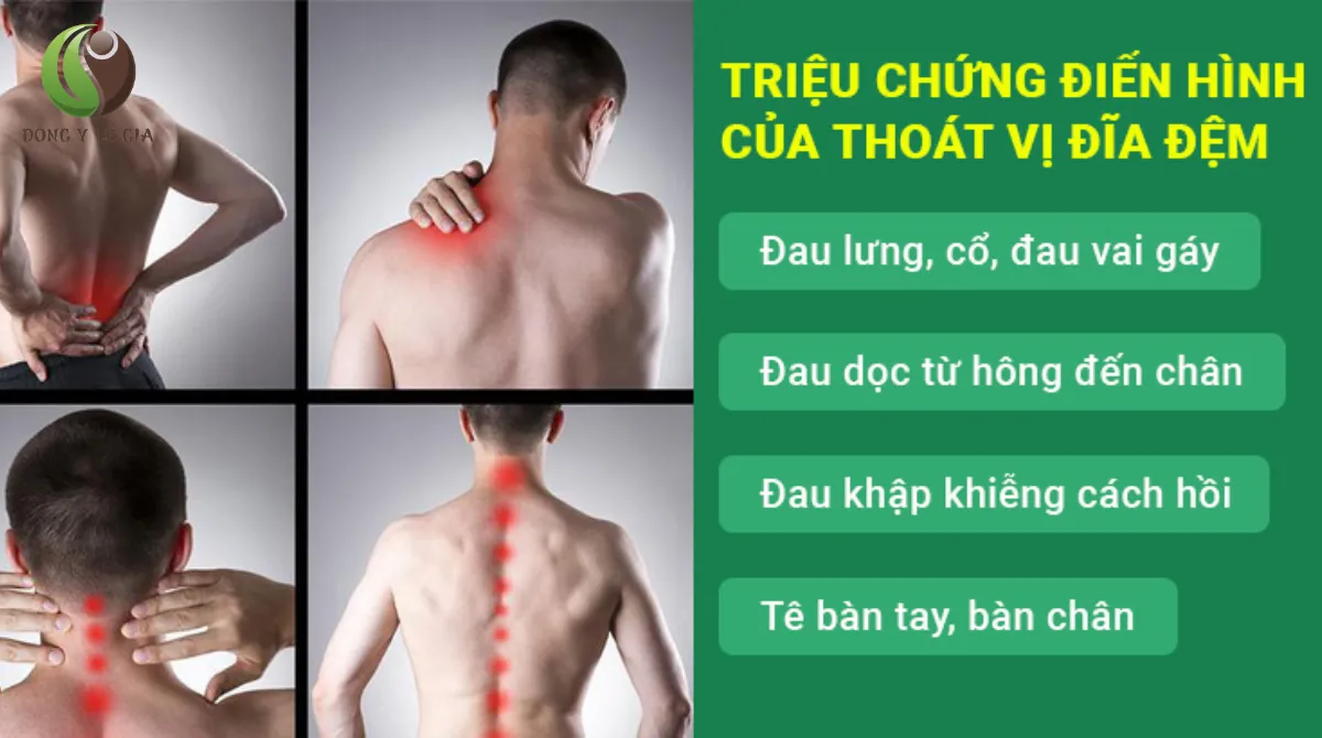 thoái hóa đĩa đệm