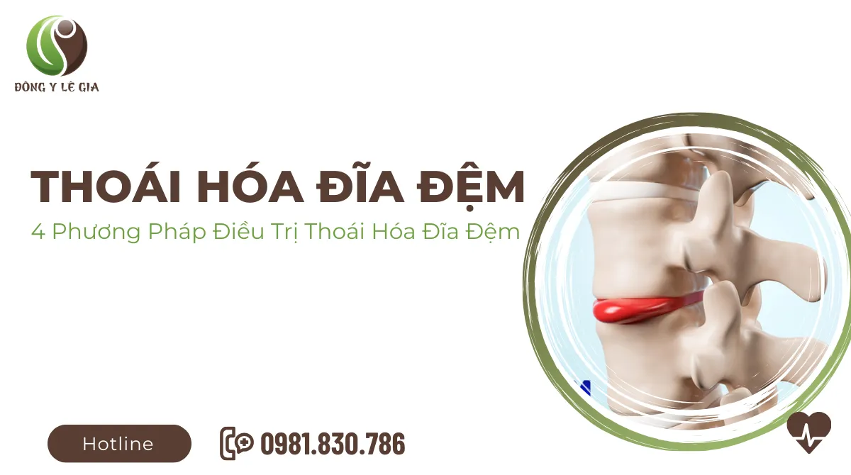 thoái hóa đĩa đệm