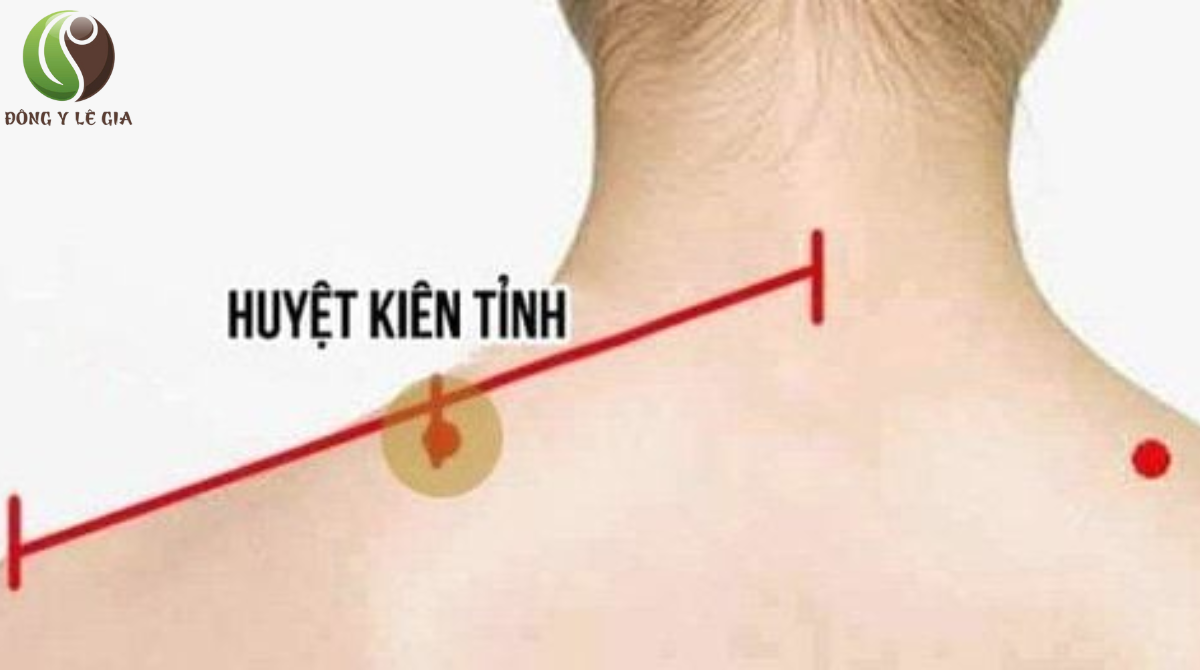 vị trí huyệt kiên tỉnh