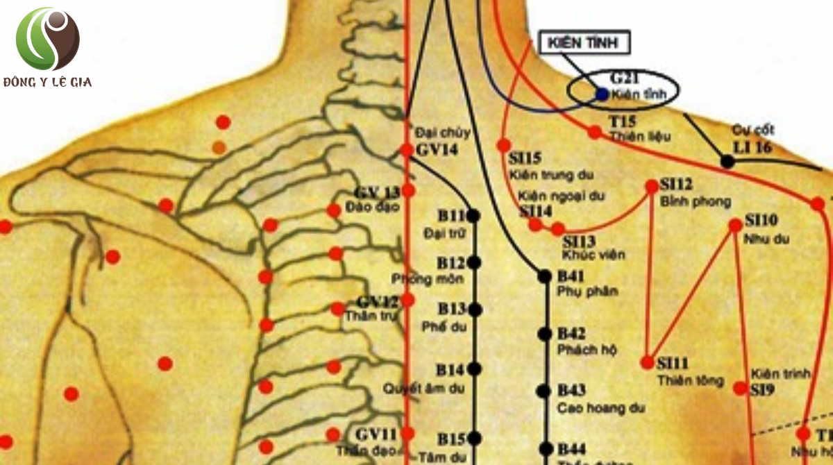 vị trí huyệt kiên tỉnh