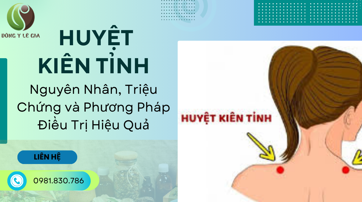 vị trí huyệt kiên tỉnh