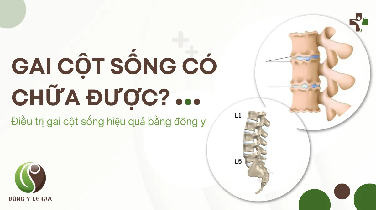 gai cột sống