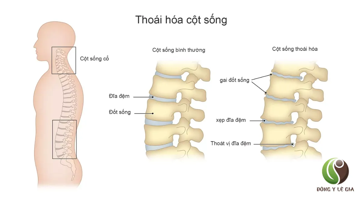 Cổ vai gáy