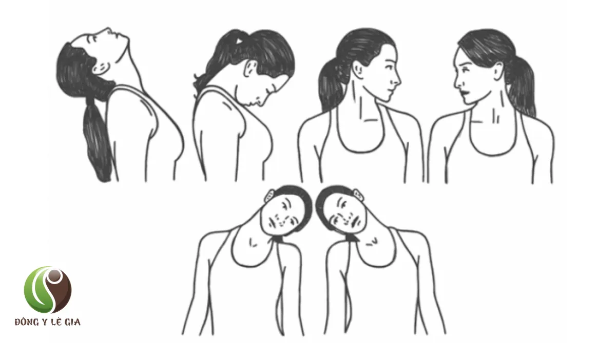 đau cổ gáy