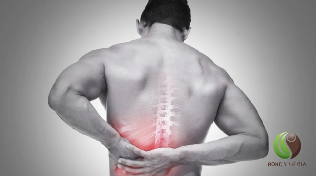 Đau cột sống lưng dưới