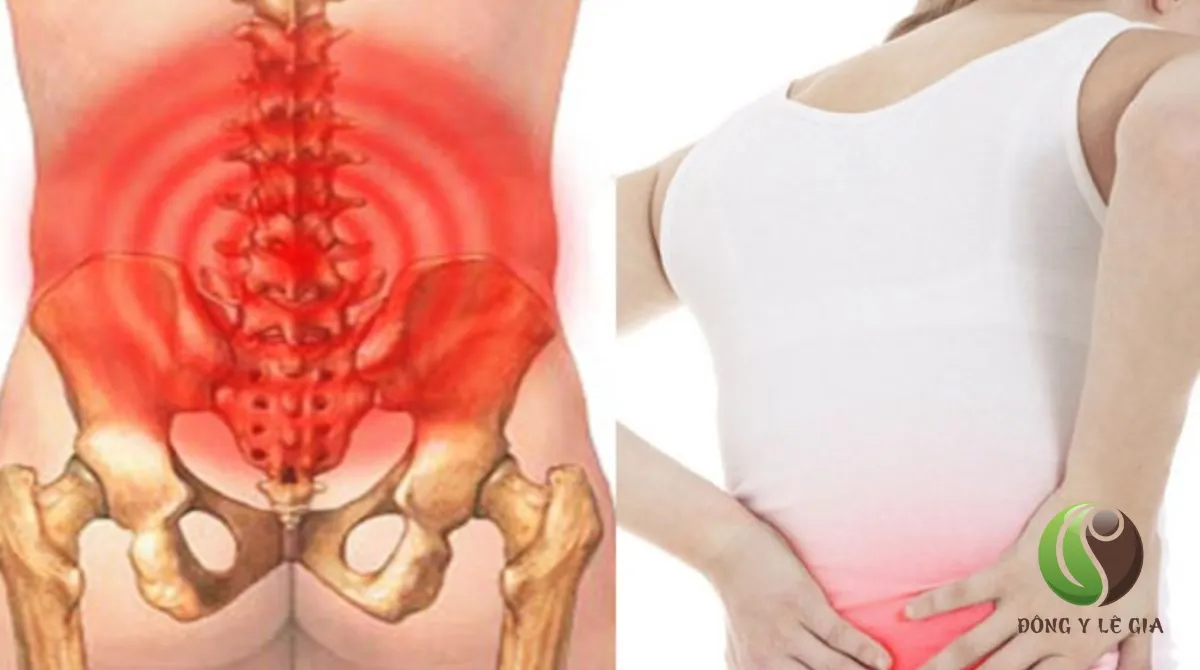 Đau cột sống lưng dưới