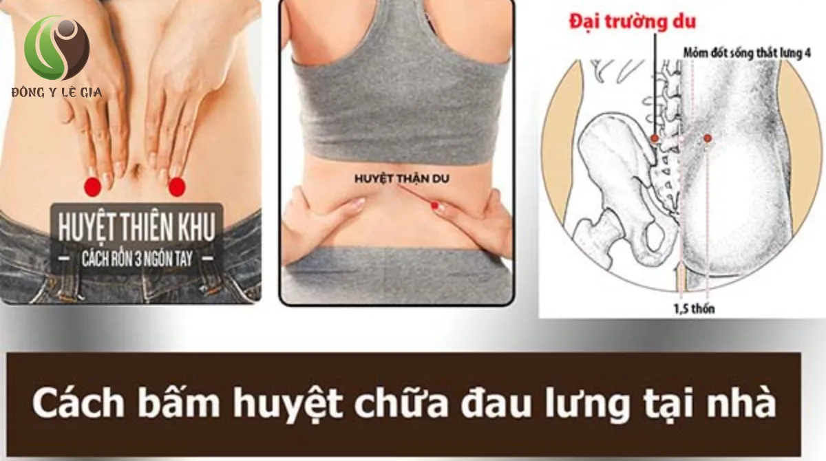 Đau cột sống lưng dưới