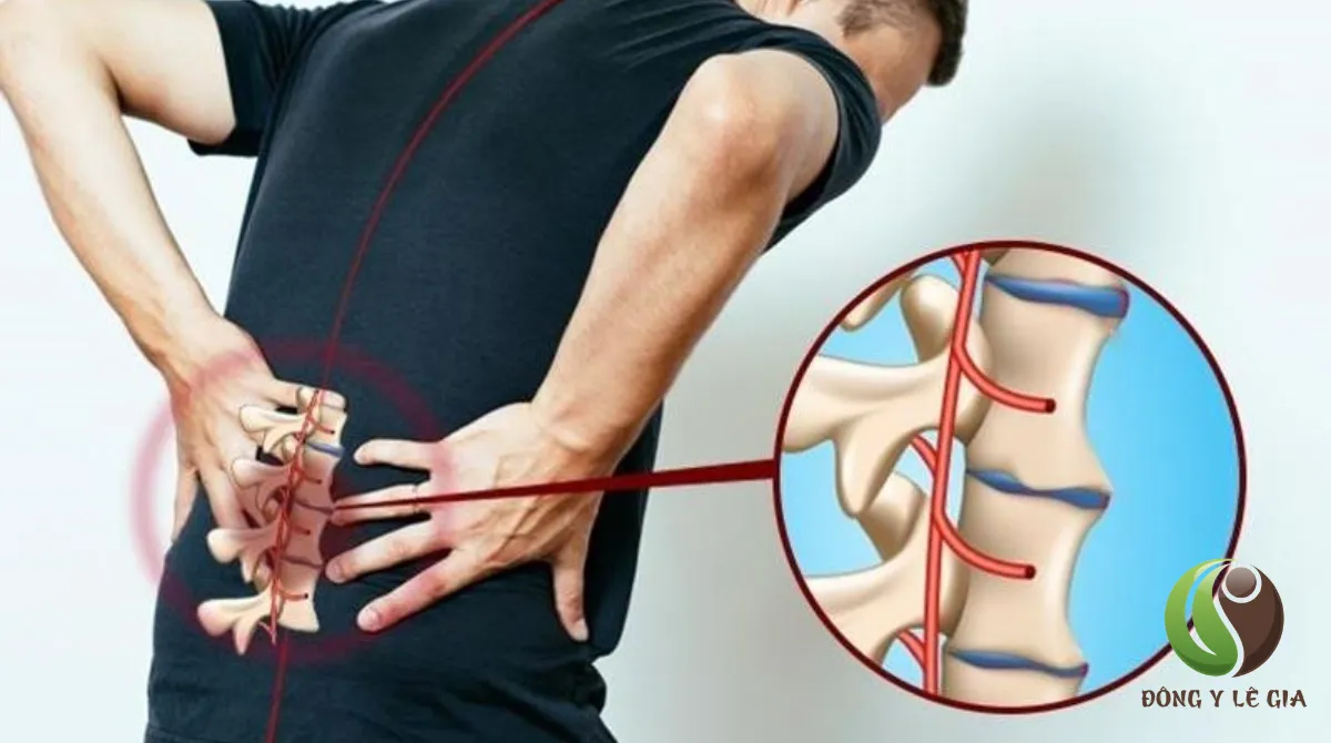mỏi lưng dưới