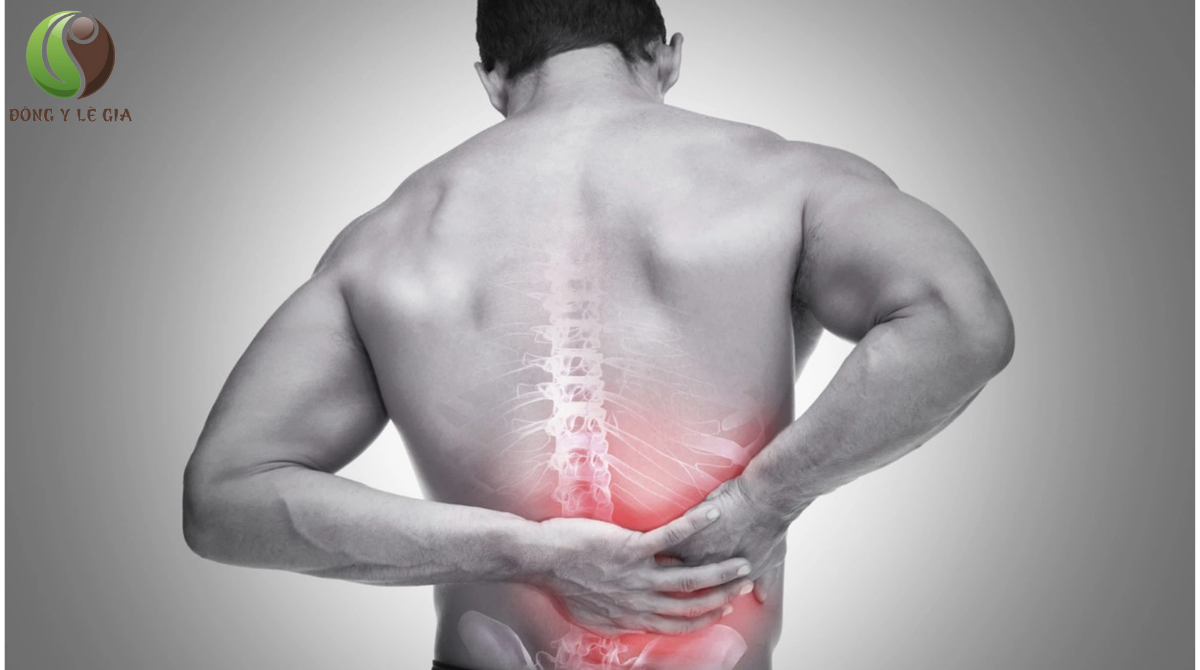 thoát vị đĩa đệm triệu chứng