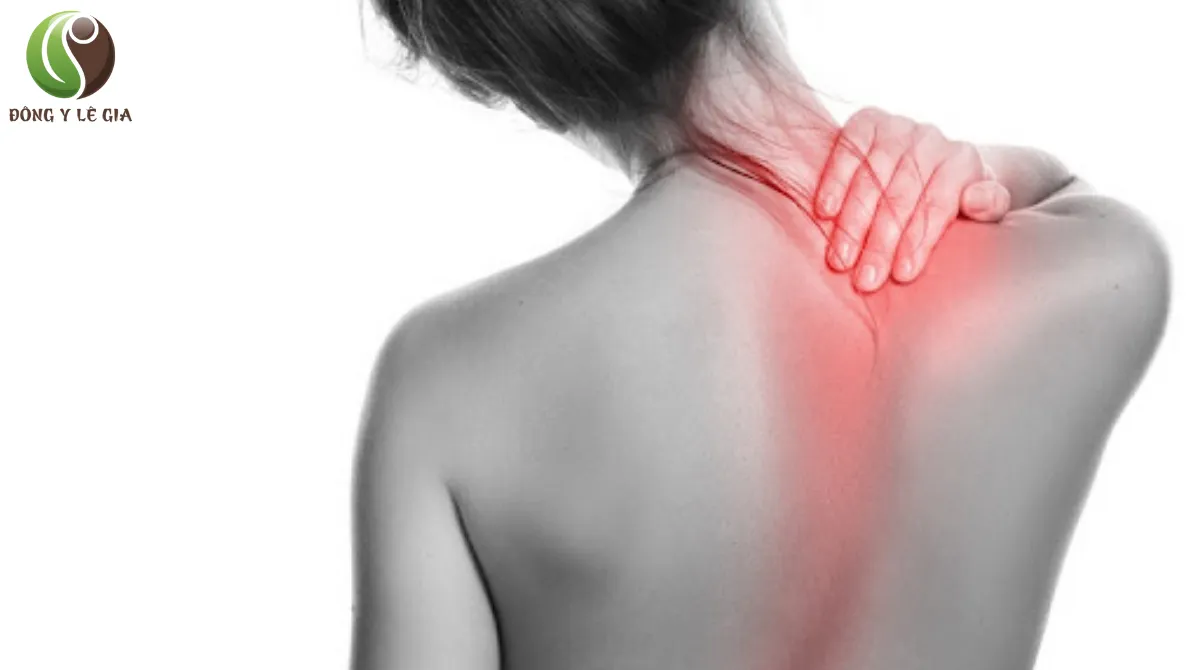 thoát vị đĩa đệm triệu chứng