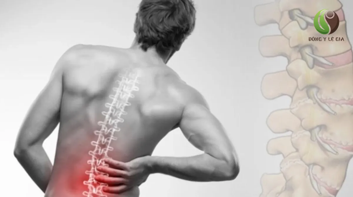 triệu chứng thoái hóa cột sống