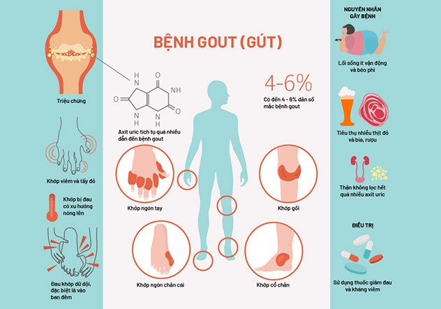 Bệnh gout