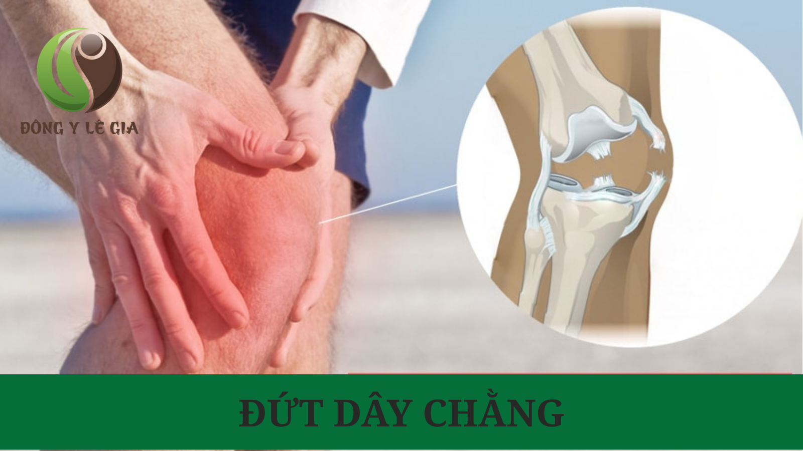 Đứt dây chằng có nguy hiểm không?