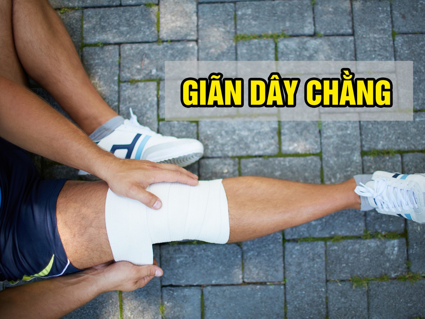 Giãn dây chằng là gì?